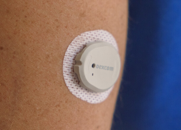 Dexcom